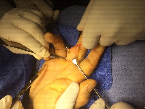 Cirugía mano